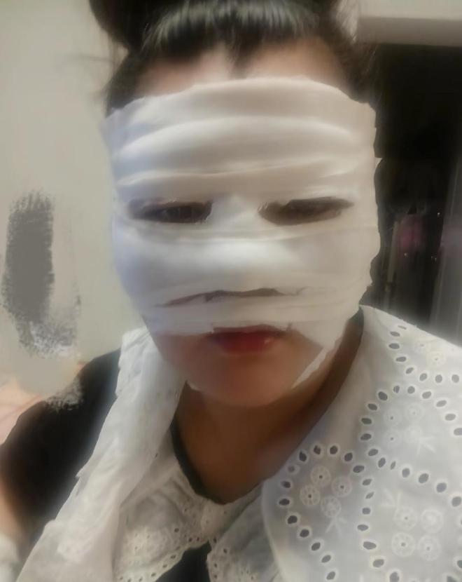 ？网友晒出多人被炸伤图看完不由得冒冷汗pg电子模拟器试玩卡式炉爆炸是有多危险(图7)